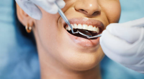 Best Emergency Dentist for Special Needs Patients in Cavalero, WA